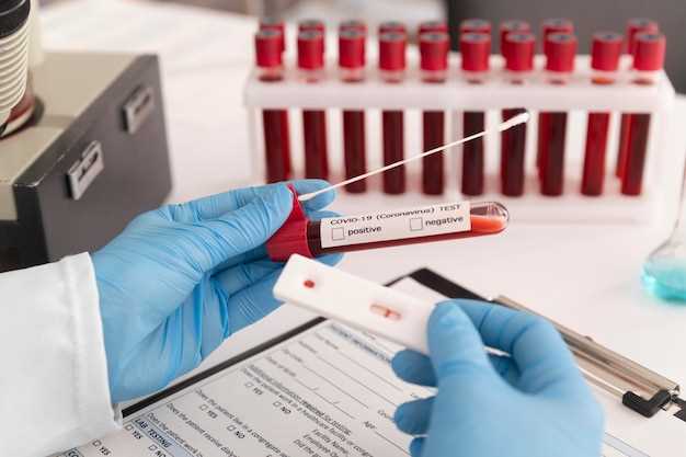 Что такое анализ нмо крови и как он проводится?