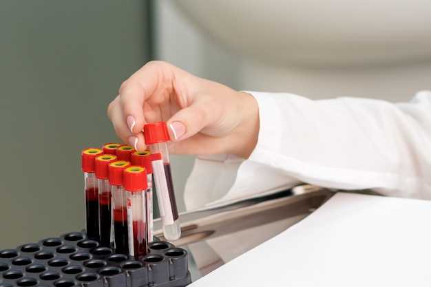 Белки в биохимическом анализе крови: функции и значения