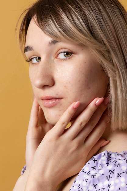 Как распознать аллергический дерматит на лице