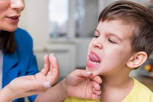 Что такое стоматит во рту у детей?