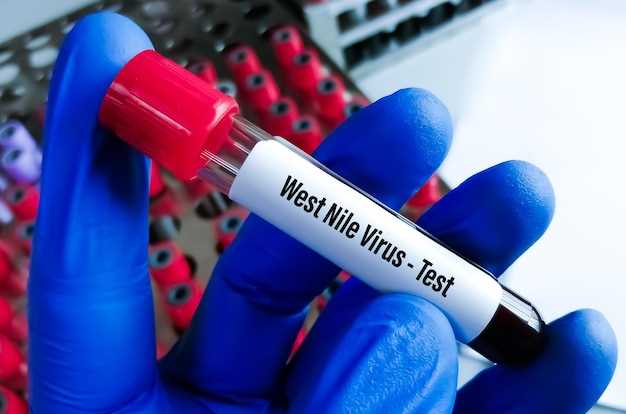 Передача ВИЧ-инфекции через кровь