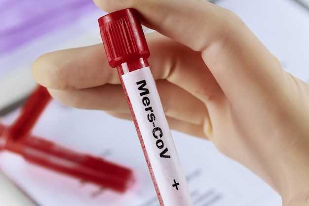 Кортизол: что это и какое значение имеет анализ крови