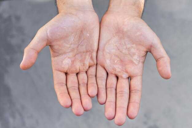 Способы ухода за кожей пальцев рук после контакта с водой