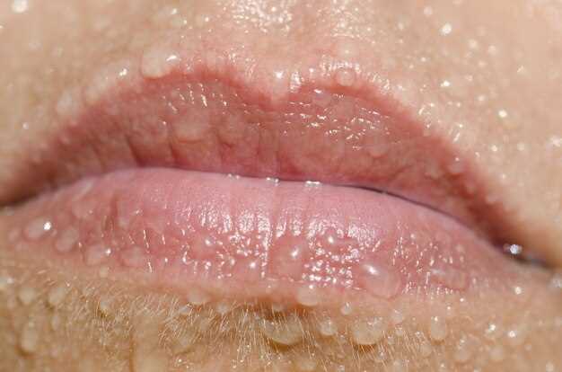Что такое папилломы на половых губах?