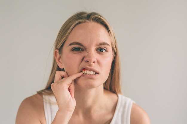 Причины трещинок в уголках рта